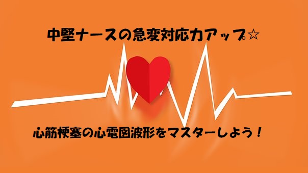 心電図波形の後ろに注目 ナースの急変対応力up 心筋梗塞の心電図波形をマスターしよう このゆびナースブログ